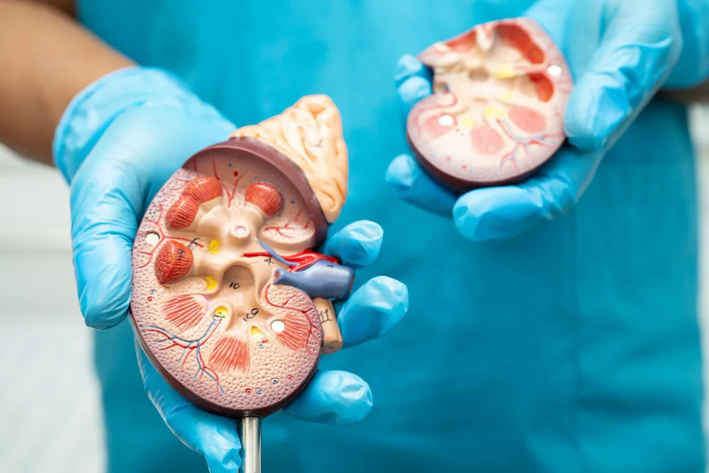 Nefrolitotomía percutánea (NLPC o PCNL) | Uróloga en CDMX y Naucalpan